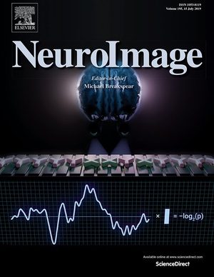 NeuroImage cover
